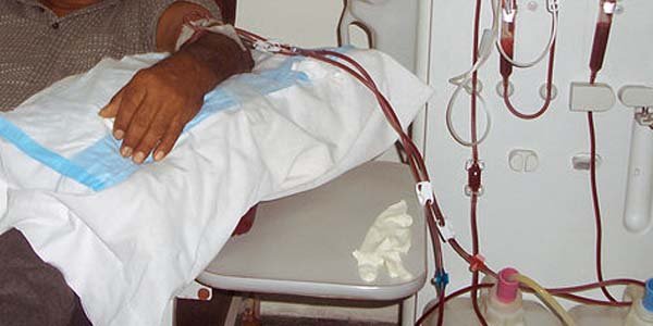 hemodialyse-bénin-santé